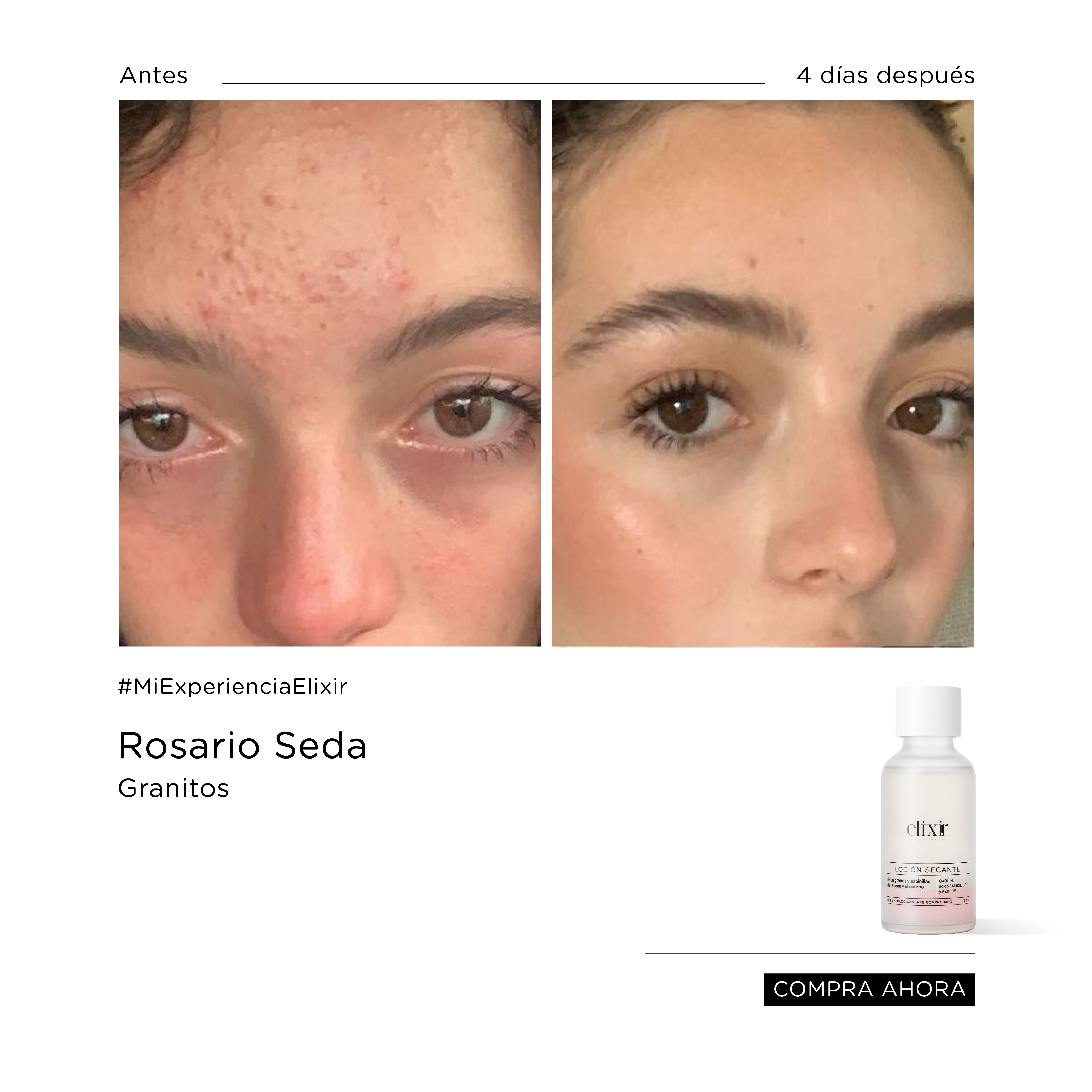 Loción Secante -LDG