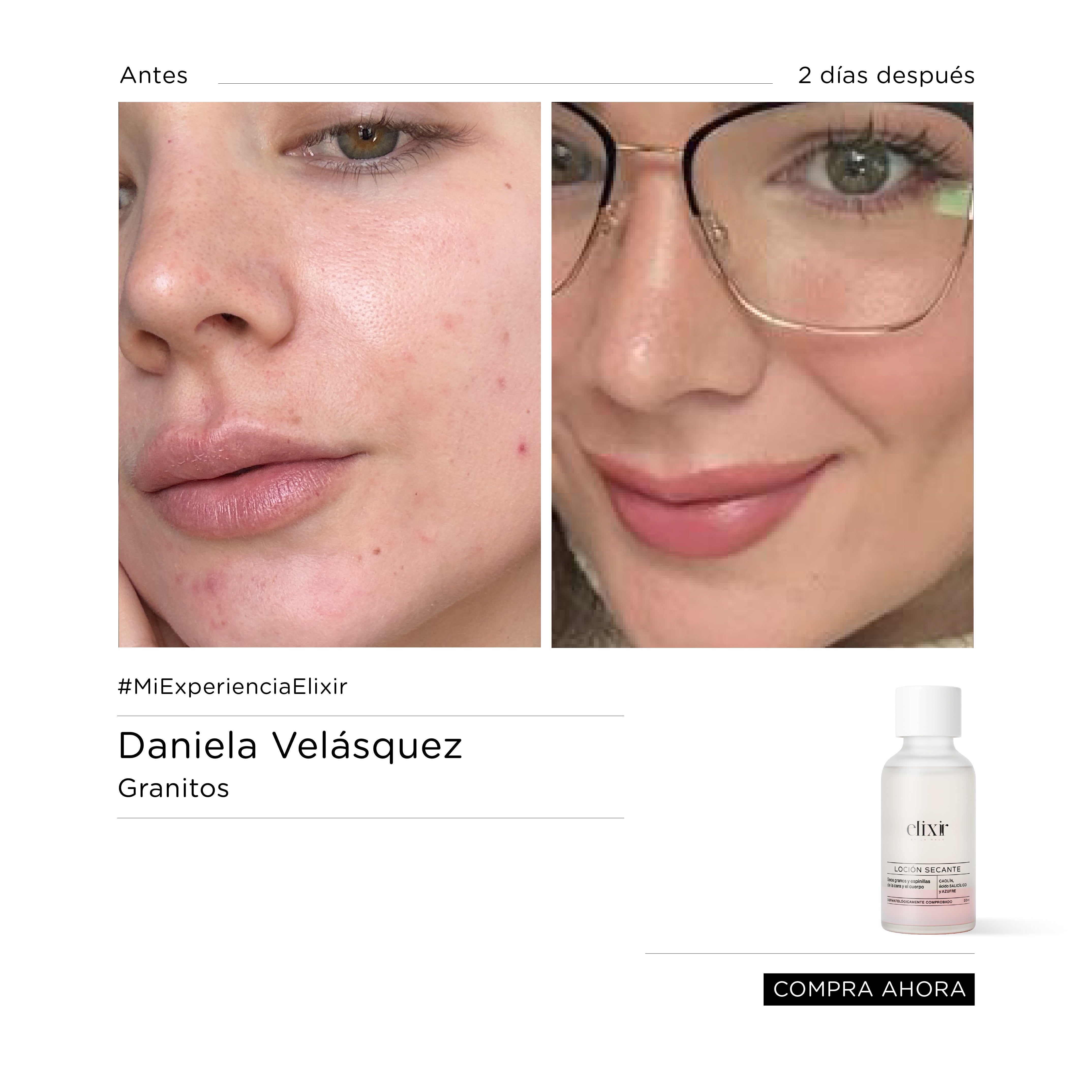 Loción Secante -LDG