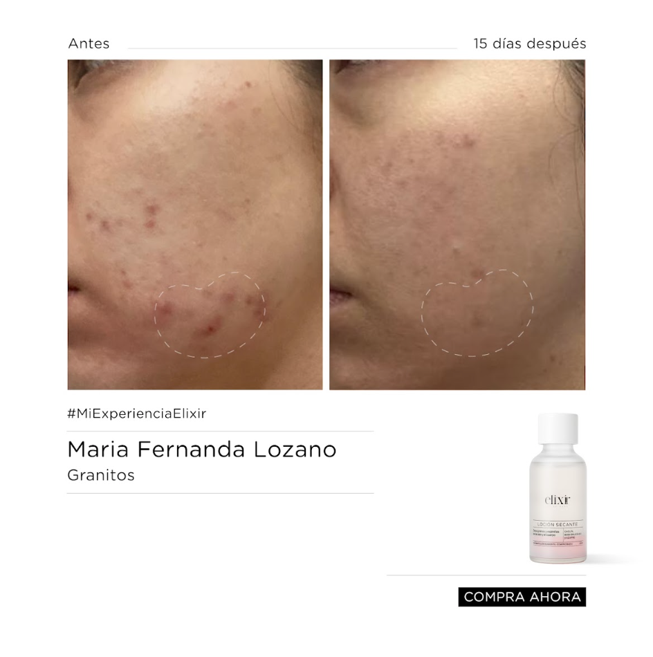 Loción Secante -LDG