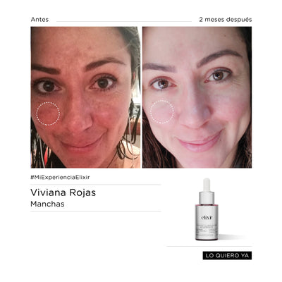 FACIAL